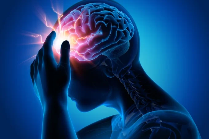 Hormonal fluctuations during the menopause can contribute to migraines.