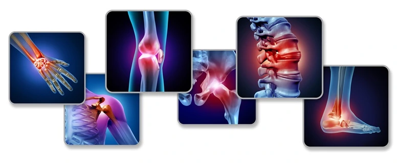 Dispelling the Rheumas: All You Need to Know About Arthritis
