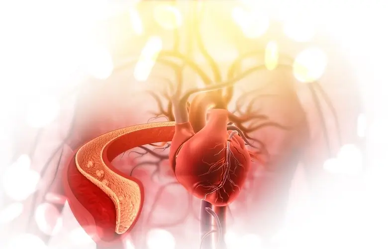 Can Supplements Reduce Plaque in Arteries?